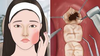 ASMR Satisfying Wisdom tooth removal | Dental care animation