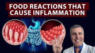 Essentials of Inflammation Ep. 4: Gluten Intolerance and Other Food Triggers of Inflammation