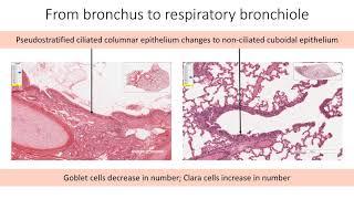 Histology with Chimmalgi: Lung