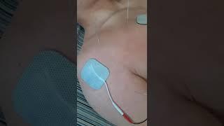 Acupuncture and electrical therapy