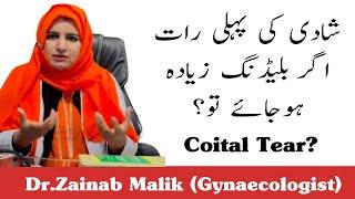 How to treat Coital tear?| Shadi ki pehli rat agar bleeding ziada ho Jay ?#premarriagecounseling