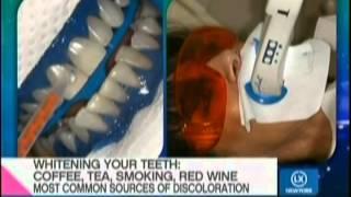 Best teeth whitening procedures and products