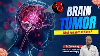 Brain Tumor: What You Need to Know? | Jeevan Rekha Superspeciality Hospital, Jaipur