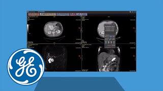 Molecular Imaging Demos on Demand Integrated Registration | GE Healthcare