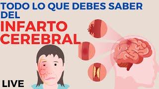 Todo lo que necesitas saber del infarto cerebral