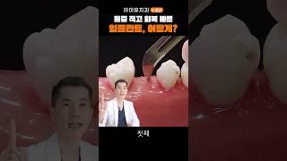 임플란트 잇몸 절개, 꼭 해야 하나요? #shrots