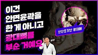 [ 안면윤곽 끝장내기 ] 제10강. 사각턱, 광대재수술을 피하는 안면윤곽병원 선택법