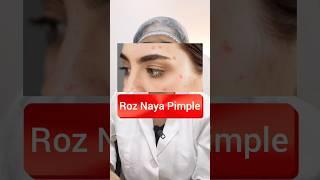 हाए Pimple  #trending #skin #acne