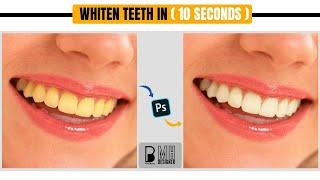 whiten teeth in 10 second | pixel bytes | mhdesigner1999