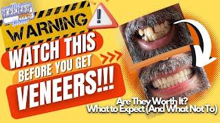 The KaleafWins Show-"Watch This Before You Get Veneers"