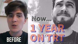 1 Year On Testosterone Replacement Therapy