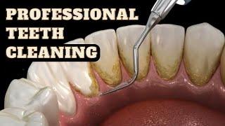 professional tooth or teeth cleaning or scaling | Facets dental clinic.