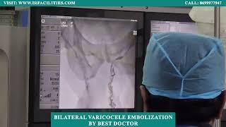 Bilateral Varicocele Embolization by the Best Doctor | Dr. Sandeep Sharma | IRFACILITIES