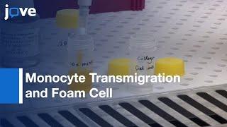 Monocyte Transmigration Quantifiction and Foam Cell Formation | Protocol Preview