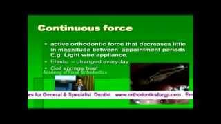 Biomechanics in Orthodontics