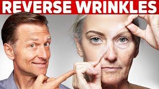 How To Reverse Wrinkles ? – Dr.Berg on Anti Aging Hormones