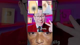 ماسك هيرجع بشرتك ١٠ سنين لورا