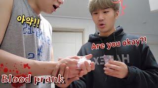 Gay couple prank! If I hurt my hand and I'm bleeding... What's my boyfriend's reaction?