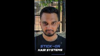 Stick - On hair Systems For Men | Human Hair