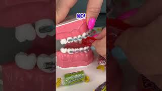 FREEZE DRIED CANDY VS BRACES  ORTHODONTIST REACTS WILL IS BREAK BRACES OFF? FOOD ASMR CRUNCH TEETH
