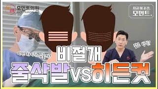 줄삭발 VS 비절개 히든컷 어떤 차이가 있을까? (무삭발모발이식) l 김경복원장 l 모먼트의원(MOMENT)