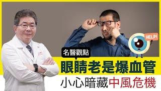 【名醫觀點】眼睛爆血管小心是容易中風的警訊