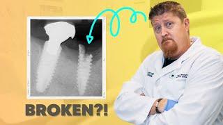 Can Dental Implants Really Break?! (You Need to Know This)