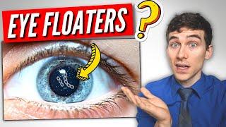 3 Must Know Facts About EYE Floaters!