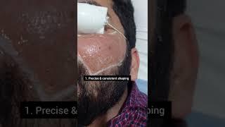 Beard Shaping for Men with Laser Hair Removal