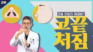 [코성형] 코수술 직후 코가 예쁘다면 이건 망한 코!? (코끝 처짐 2부)