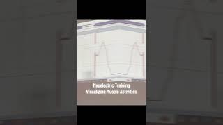 Myoelectric Training