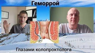 Геморрой. Глазами колопроктолога.