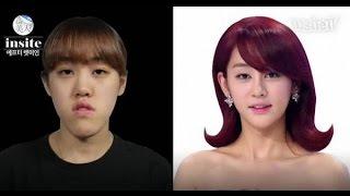 Huh ye eun | Let me in TV Show, korea plastic surgery before and after