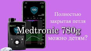 СТОИТ ЛИ ПОКУПАТЬ MEDTRONIC 780 / 770g? ОТЛИЧИЕ ОТ 670g