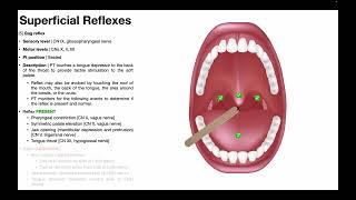 Gag Reflex | Procedure & Results Interpretation