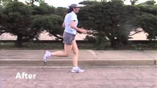 Running- Sciatica and Hamstring Pain Gone with Running Form Correction