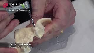 Pterygoid Placement Demo