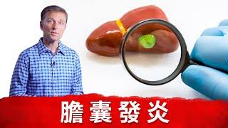 膽囊摘除,可隨便吃喝？引起膽囊炎？膽汁不足缺少營養素？柏格醫生dr berg