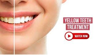 Yellow Teeth Treatment | Tips to Whiten Teeth and Avoid Common Mistakes | Royal Dental Clinics