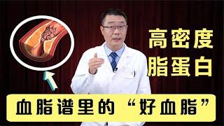 高密度脂蛋白，血脂里面的“好血脂”！医生说：它越高越好！