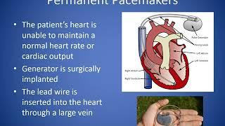 Pacemakers video