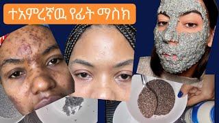 ብጉርን እና ጥቁር ጥቁሩን እልም አርጎ የሚያጠፋ በቀላል ቤት ዉስጥ የሚሰራ /flaxseed/chia seed/ face mask