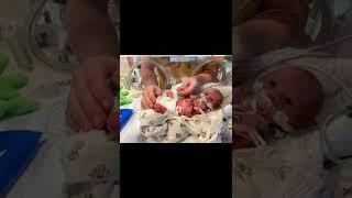 First time holding our 28 week preemie daughters. #preemiebaby