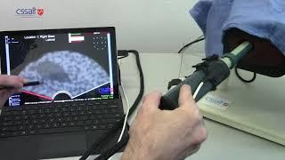 Visualized Prostate Biopsy (vPBx) proof of concept system on a prostate biopsy simulator