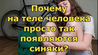 Почему на теле человека просто так появляются синяки?