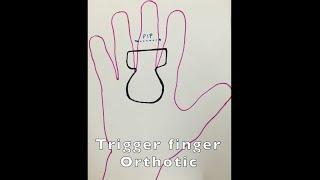 Trigger Finger Orthotic/Splint Fabrication in Hand Therapy Setting