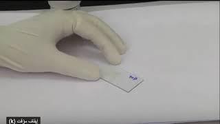 Direct faecal smear