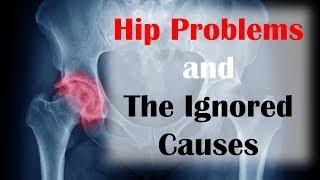 Hip Problems and the Ignored Causes