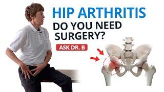 Should I Get Surgery for Hip Osteoarthritis? (Ask Dr. B)