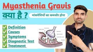 Myasthenia Gravis in Hindi | Causes, Symptoms And Treatment of Myasthenia Gravis